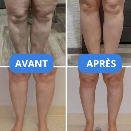 CompressSocks - Chaussettes de compression