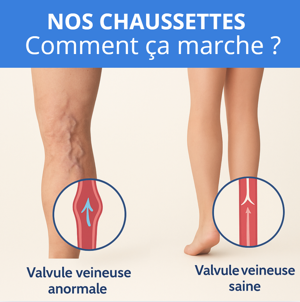 CompressSocks - Chaussettes de compression