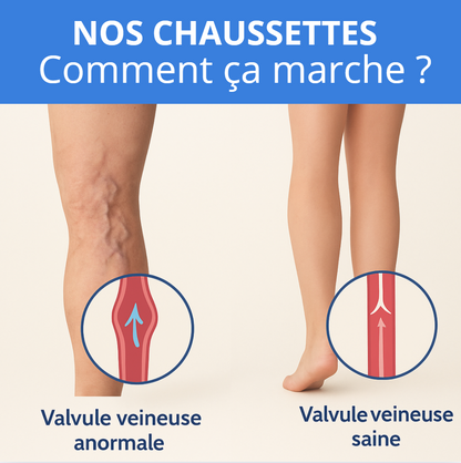 CompressSocks - Chaussettes de compression
